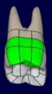 mceclip8.png