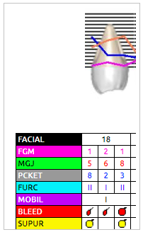 mceclip1.png
